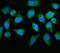 Myotubularin-related protein 2 antibody, A04202-1, Boster Biological Technology, Immunofluorescence image 