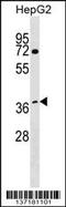 DDB1- and CUL4-associated factor 7 antibody, 59-117, ProSci, Western Blot image 