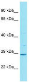 HAUS Augmin Like Complex Subunit 2 antibody, TA337336, Origene, Western Blot image 