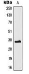Low Density Lipoprotein Receptor Class A Domain Containing 3 antibody, orb224143, Biorbyt, Western Blot image 