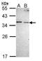 Nitric Oxide Synthase Interacting Protein antibody, TA308380, Origene, Western Blot image 