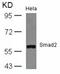 SMAD2 antibody, 79-618, ProSci, Western Blot image 