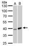 Galactokinase 1 antibody, GTX105024, GeneTex, Western Blot image 