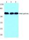 P21 (RAC1) Activated Kinase 3 antibody, A03124S154, Boster Biological Technology, Western Blot image 