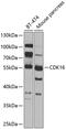 Cyclin Dependent Kinase 16 antibody, 23-427, ProSci, Western Blot image 