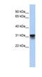 KDEL Endoplasmic Reticulum Protein Retention Receptor 3 antibody, NBP1-62653, Novus Biologicals, Western Blot image 