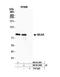 Kinesin Family Member 2C antibody, NB100-2588, Novus Biologicals, Western Blot image 