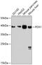 Pancreas/duodenum homeobox protein 1 antibody, A00491, Boster Biological Technology, Western Blot image 