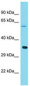 Abl Interactor 1 antibody, TA343320, Origene, Western Blot image 