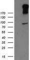 Leucine Rich Repeat Containing G Protein-Coupled Receptor 5 antibody, M00239-1, Boster Biological Technology, Western Blot image 