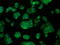 Aconitase antibody, GTX84965, GeneTex, Immunofluorescence image 
