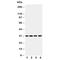 Superoxide Dismutase 3 antibody, R30999, NSJ Bioreagents, Western Blot image 