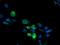 Cytochrome P450 Family 2 Subfamily B Member 6 antibody, NBP2-01800, Novus Biologicals, Immunofluorescence image 