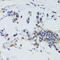 DNA Methyltransferase 1 antibody, 16-768, ProSci, Immunohistochemistry paraffin image 