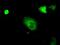 cGMP-dependent protein kinase 1 antibody, GTX83812, GeneTex, Immunofluorescence image 