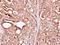 SAT antibody, GTX103608, GeneTex, Immunohistochemistry paraffin image 