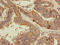 Ribosomal Protein L19 antibody, orb51014, Biorbyt, Immunohistochemistry paraffin image 
