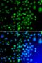 Protein Phosphatase 3 Regulatory Subunit B, Beta antibody, orb248026, Biorbyt, Immunocytochemistry image 