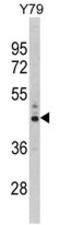 Proteasome 26S Subunit, Non-ATPase 13 antibody, AP17682PU-N, Origene, Western Blot image 