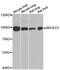 Melanoma-associated antigen D1 antibody, MBS127359, MyBioSource, Western Blot image 