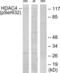 Histone Deacetylase 4 antibody, LS-C199042, Lifespan Biosciences, Western Blot image 