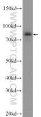 Poly(A) Polymerase Gamma antibody, 24284-1-AP, Proteintech Group, Western Blot image 