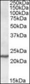 Secretion Associated Ras Related GTPase 1A antibody, orb89728, Biorbyt, Western Blot image 