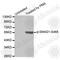 SMAD Family Member 1 antibody, AP0268, ABclonal Technology, Western Blot image 