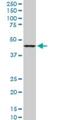 LAG1 longevity assurance homolog 6 antibody, H00253782-M02, Novus Biologicals, Western Blot image 