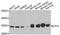 Electron transfer flavoprotein subunit alpha, mitochondrial antibody, A7670, ABclonal Technology, Western Blot image 