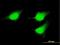 Mitogen-Activated Protein Kinase Kinase 5 antibody, H00005607-M04, Novus Biologicals, Immunofluorescence image 