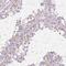 Protein C19orf84  antibody, HPA068082, Atlas Antibodies, Immunohistochemistry paraffin image 