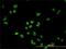 Polypyrimidine Tract Binding Protein 1 antibody, H00005725-M01, Novus Biologicals, Immunofluorescence image 
