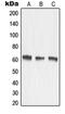 Matrix Metallopeptidase 15 antibody, orb214266, Biorbyt, Western Blot image 