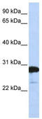 RAN Binding Protein 1 antibody, TA339255, Origene, Western Blot image 