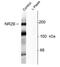 GRIN2B antibody, AHP1004, Bio-Rad (formerly AbD Serotec) , Western Blot image 