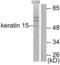 Keratin 15 antibody, LS-B7199, Lifespan Biosciences, Western Blot image 