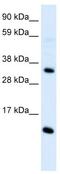 C-C Motif Chemokine Ligand 18 antibody, ab104867, Abcam, Western Blot image 