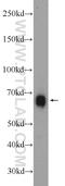 Establishment Of Sister Chromatid Cohesion N-Acetyltransferase 2 antibody, 23525-1-AP, Proteintech Group, Western Blot image 