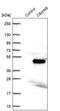Chromosome 8 Open Reading Frame 48 antibody, PA5-55618, Invitrogen Antibodies, Western Blot image 