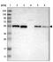 Zinc Finger Protein 70 antibody, NBP1-84402, Novus Biologicals, Western Blot image 