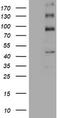 ALK Receptor Tyrosine Kinase antibody, TA801178S, Origene, Western Blot image 