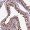 Chromosome 3 Open Reading Frame 70 antibody, NBP1-86223, Novus Biologicals, Immunohistochemistry frozen image 