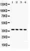 COP9 Signalosome Subunit 5 antibody, PA5-79060, Invitrogen Antibodies, Western Blot image 