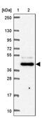 Farnesyltransferase, CAAX Box, Beta antibody, PA5-64061, Invitrogen Antibodies, Western Blot image 