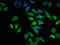 ATPase H+ Transporting V1 Subunit G2 antibody, CSB-PA002409LA01HU, Cusabio, Immunofluorescence image 