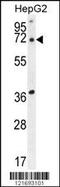Acyl-CoA Thioesterase 11 antibody, 55-048, ProSci, Western Blot image 