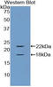 Colony Stimulating Factor 2 Receptor Alpha Subunit antibody, LS-C293447, Lifespan Biosciences, Western Blot image 