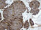 Epoxide Hydrolase 1 antibody, LS-C799471, Lifespan Biosciences, Immunohistochemistry paraffin image 