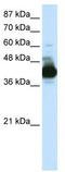 Cleavage Stimulation Factor Subunit 3 antibody, TA345771, Origene, Western Blot image 